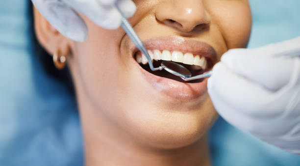 Best Broken or Cracked Tooth Emergency Dentist in Troup, TX
