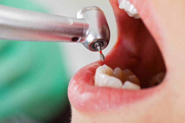 Best Urgent Dental Care for Toothache in Troup, TX